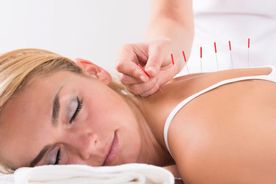 afvallen met acupunctuur