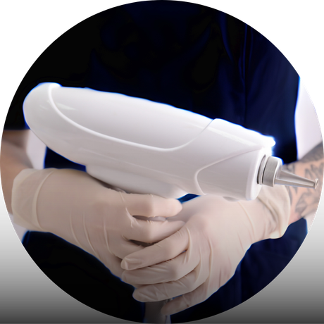 Laser Removal Consultatie
