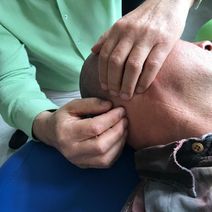 SPP - handplaatsing aan de basis van de schedel