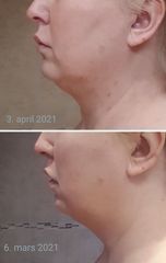 JAW