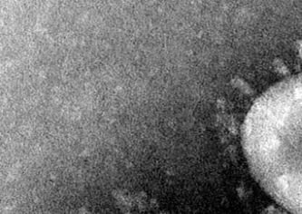 Mikroskopi bilde av Coronavirus hentet fra Wickipedia