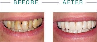 Offering All Your Dental Services At Great Prices!