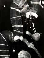 Interference_01