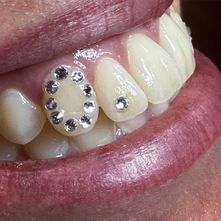 round tooth gem