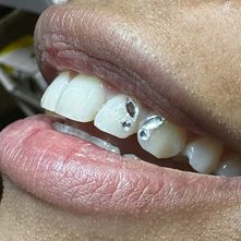 butterfly tooth gem
