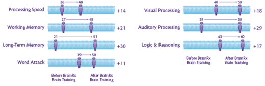 BrainRx