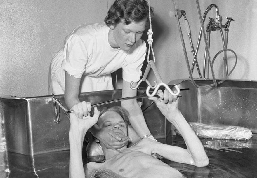 Göteborgs barnsjukhus var först i världen med barnintensivvård. Många av de som hade drabbats av polio i unga år fanns kvar här sedan dess och skulle aldrig kunna lämna sjukhuset levande.