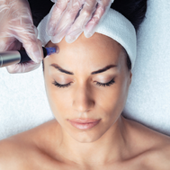 Dermapen & Uber Peel