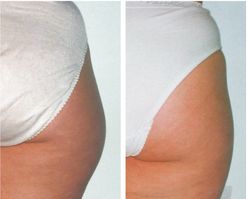 beforeandafter_body_2 copy