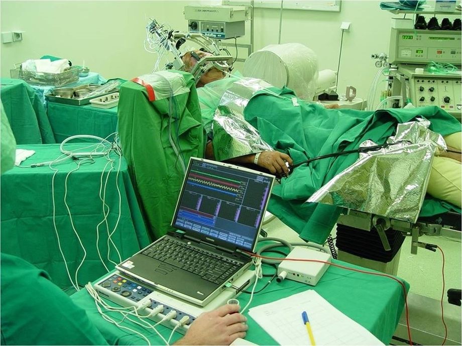 Φωτογραφία από χειρουργείο μας κατά τη διάρκεια επέμβασης Deep Brain Stimulation για νόσο πάρκινσον.