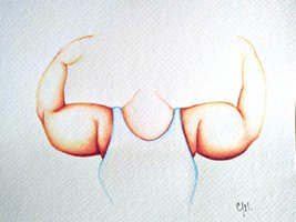 Corpus Mundi Lipoedème bras chauve-souris Corpus Mundi Lipoedème bras chauve-souris