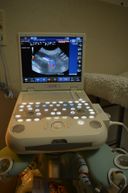 Echografie toestel met kleuren doppler