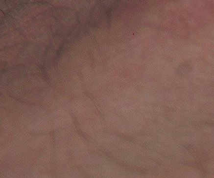 Psykisk helse i arbeidslivet