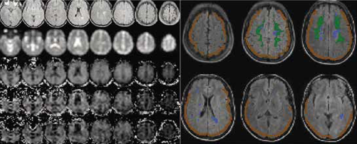 Scanning_hjernesnit