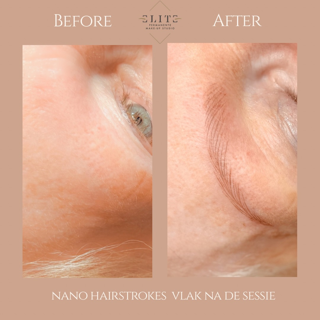 nano hairstrokes voor en na 