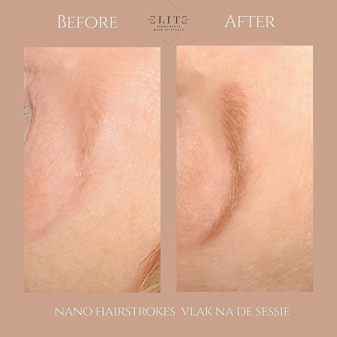 nano hairstrokes voor en na 
