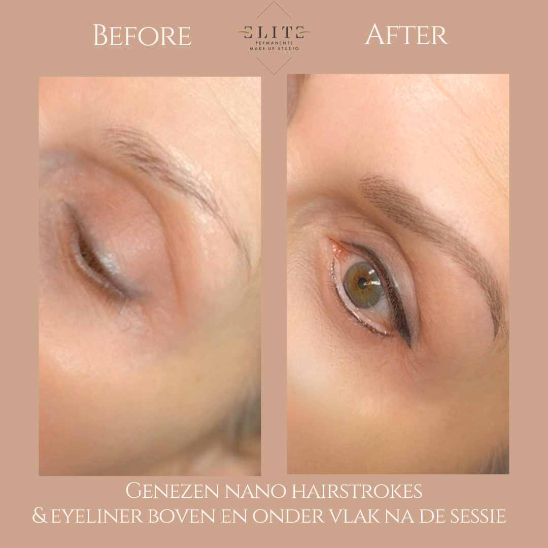 nano hairstrokes voor en na 