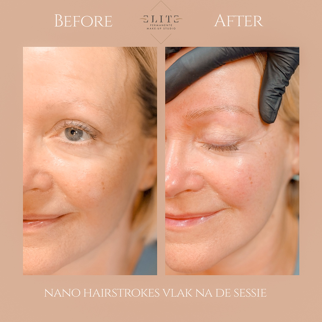 nano hairstrokes voor en na 