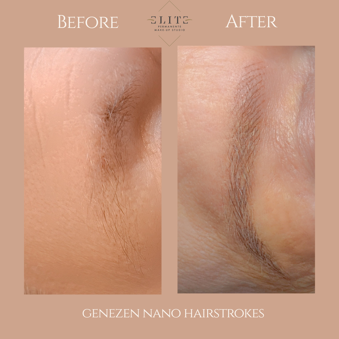 nano hairstrokes voor en na 