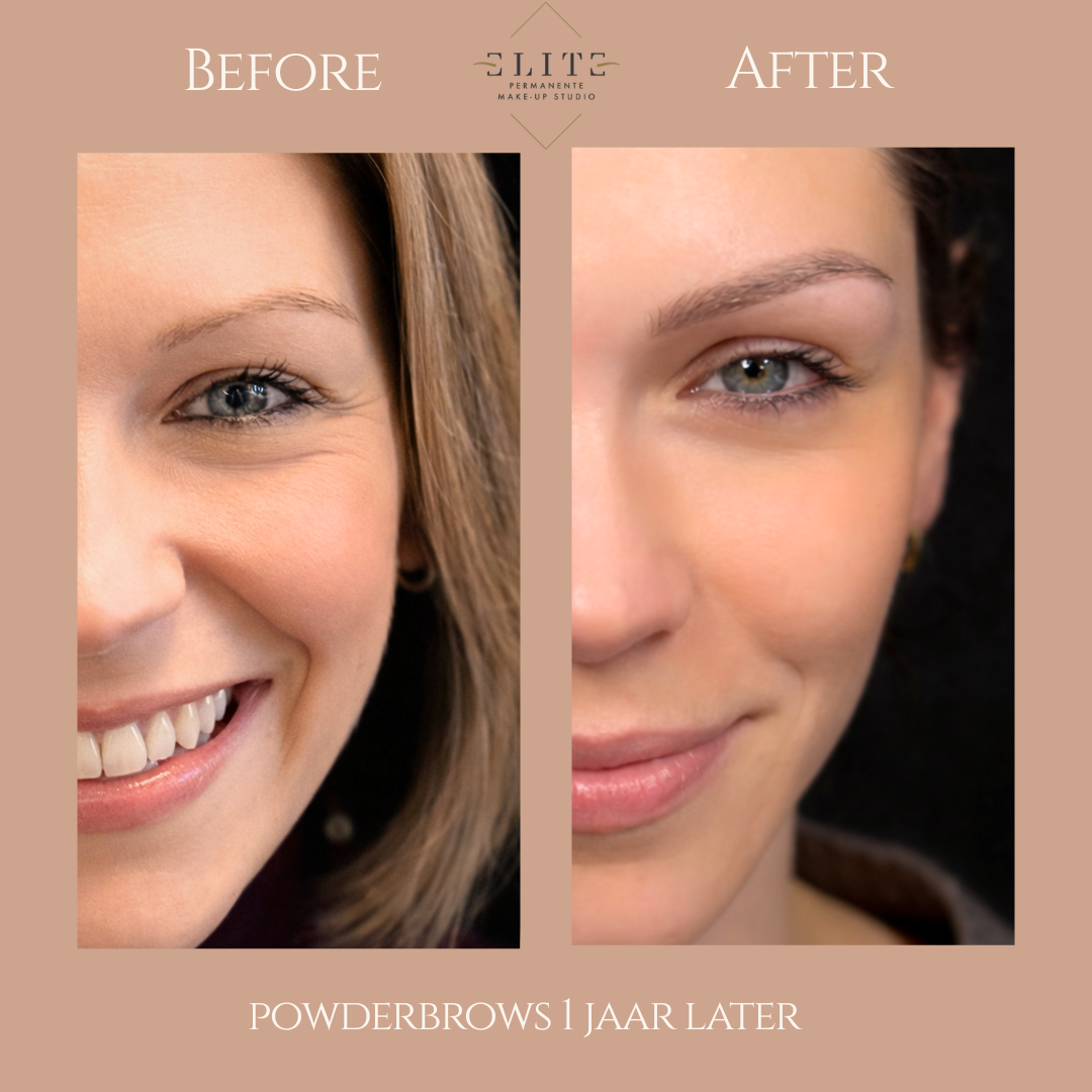 Voor & na resultaten powderbrows