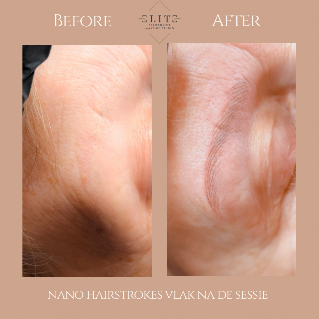 nano hairstrokes voor en na 