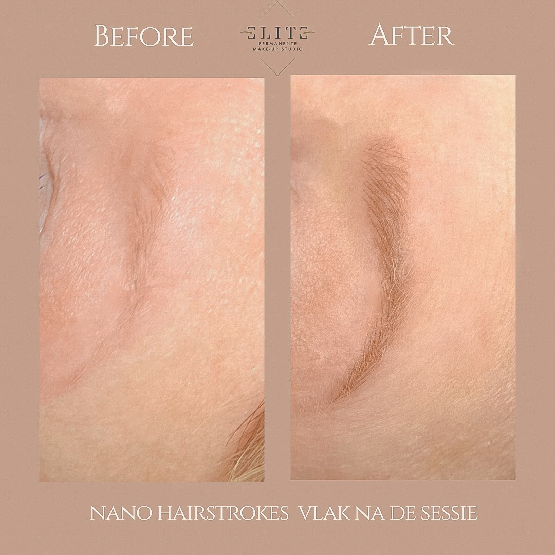 nano hairstrokes voor en na 