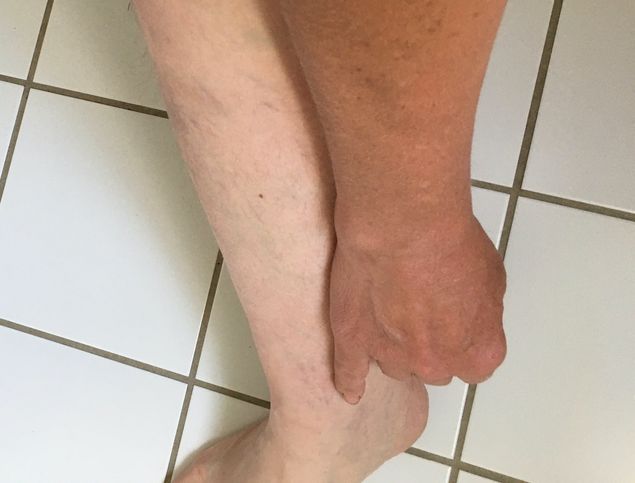 Efter några dagars arbete i sol blir jag lite brunare på armarna. Jag har alltid på mig snickarbyxor, så denna vita färg behåller mina ben hela säsongen... 🤣 Alla som är på badstranden de tre gångerna per säsong jag är där, får sig ett gott skratt 🤣. Äkta bonnabränna; bruna armar, nacke och ansikte.