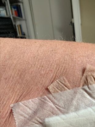 Sådan så det ud da jeg forlod hospitalet.