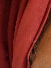 My “fish gill” tan line.