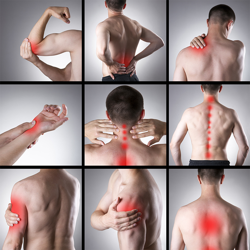 Bilde som indikerer steder hvor mange får muskelsmerter ved fibromyalgi