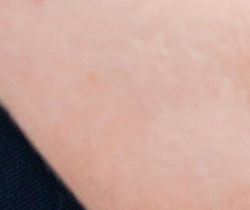 Fysioterapeut hjelper pasient med rebabilitering
