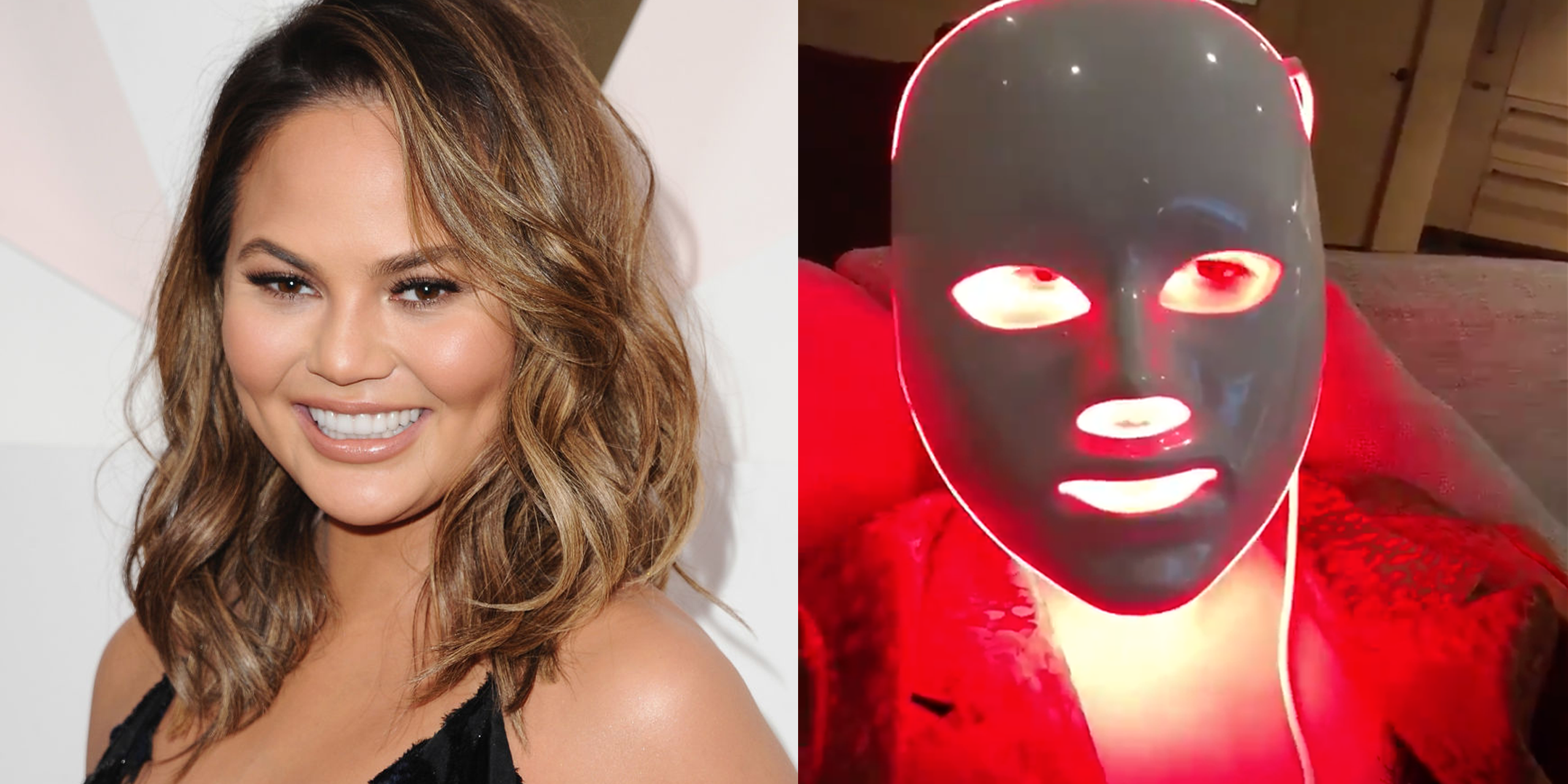 chrissy-teigen-led-light-therapy-mask-1540491865
