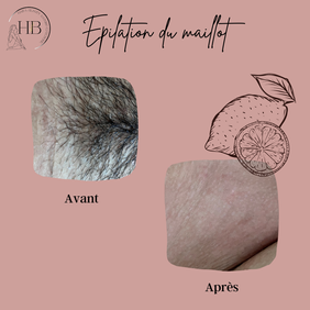 EPILATION ORIENTALE DU MAILLOT INTEGRAL