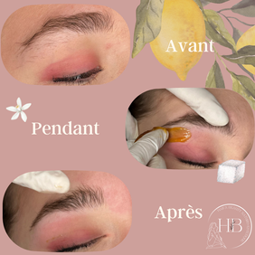 epilation sourcils