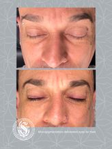 Micropigmentation Eye-liner for men Bélgica