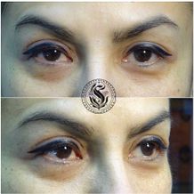 Micropigmentation Eye-liner Argentina