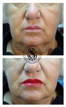 Micropigmentation Full Lip Argentina