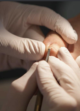 Fodterapi Tåneglebehandling og behandling af fortykket Negle hos Himmelev fodterapeut Roskilde