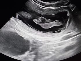 echo 03/11/2022