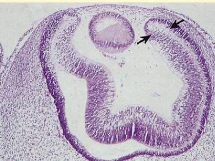 The two layers of the neuroepithelium of the optic cup (arrows) become the anterior and posterior IPE, and the iris stroma is derived from neural crest tissue (hematoxylin-eosin, X63).