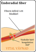 Endoradial fiber - Schematisk
