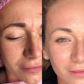 JM Derma Kosmetik_BB-Glow