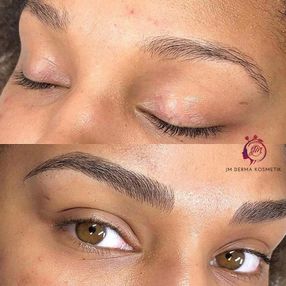 JM Derma Kosmetik_Microblading