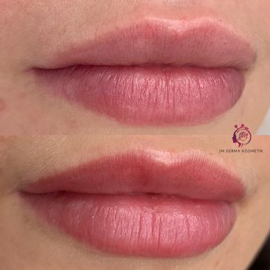 JM Derma Kosmetik_Lippenvollpigmentierung PMU