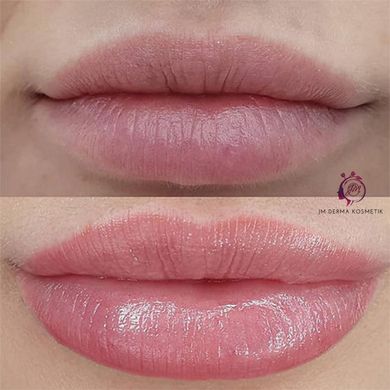 JM Derma Kosmetik_Aqualips