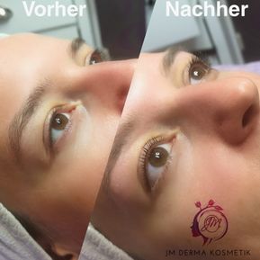 JM Derma Kosmetik Wimpernlifting
