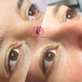 JM Derma Kosmetik Wimpernlifting