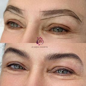 W-Brows, JM Derma Kosmetik (7)