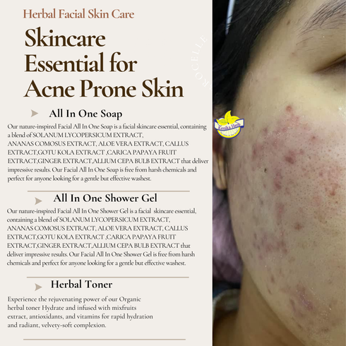 Brown Beige Simple Acne Skincare 1