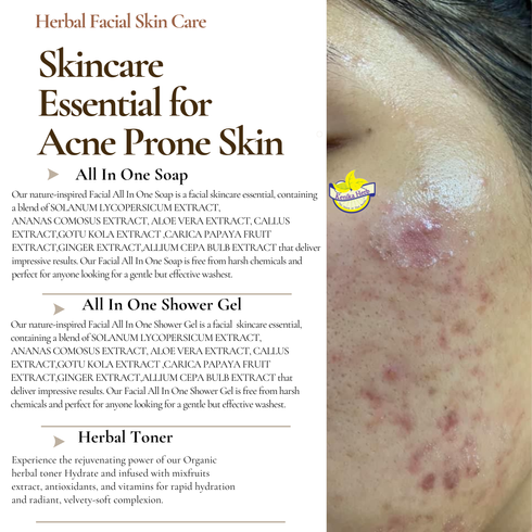 Brown Beige Simple Acne Skincare 2